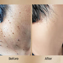 BEEVENON SPRAY PARA REMOÇÃO