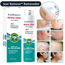 Scar Remove™ Removedor de Cicatrizes e Marcas de Expressão