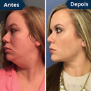 FaceLift™ Redutor de Rugas e Papada da LOJA VIVA LAR, creme exclusivo e rosto com aparência rejuvenescida.