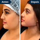FaceLift™ Redutor de Rugas e Papada da LOJA VIVA LAR, creme exclusivo e produto para rejuvenescimento facial.