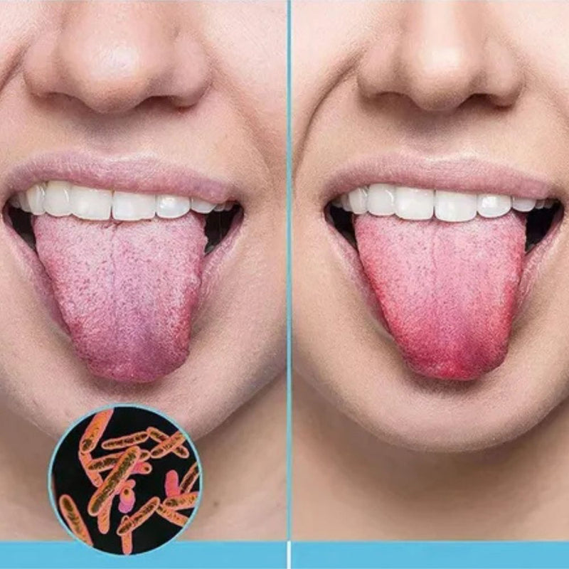 Raspador de Língua Removedor de Bactérias em Aço Inoxidável - Compre 1 Leve 3