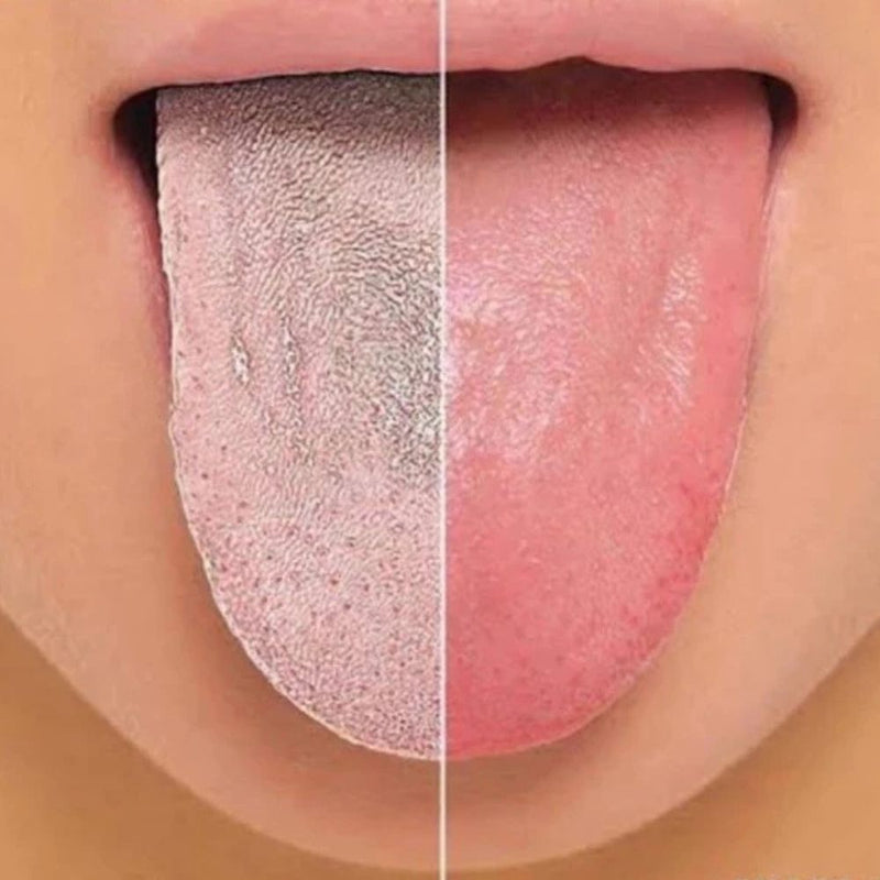 Raspador de Língua Removedor de Bactérias em Aço Inoxidável - Compre 1 Leve 3