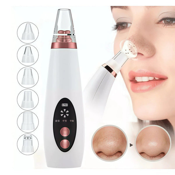 Removedor Elétrico de Cravos e Espinhas A Vácuo Recarregável